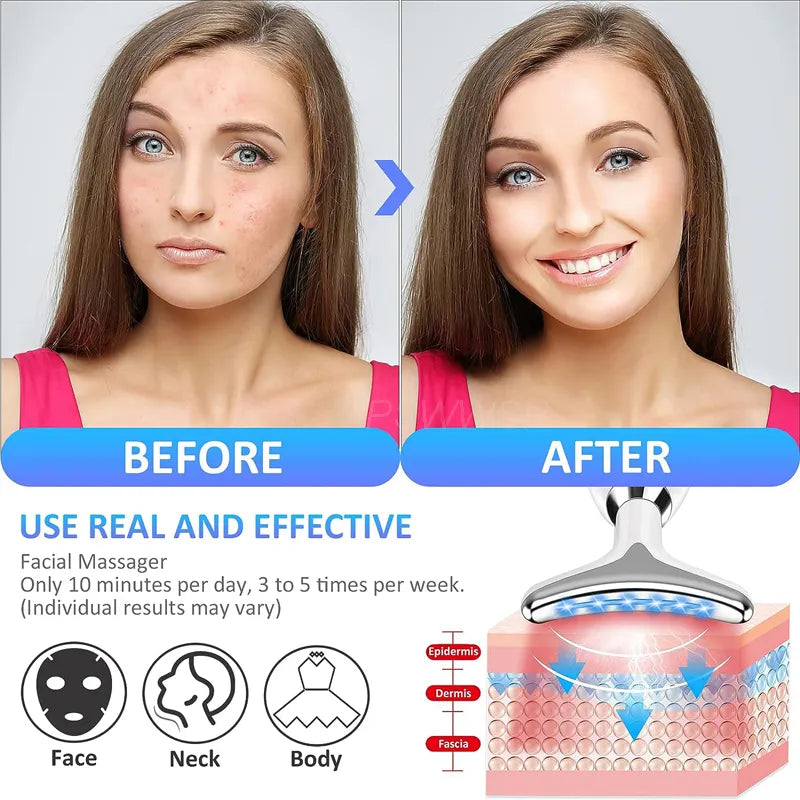 3-Color Facial Light Therapy Massage Device Comparison