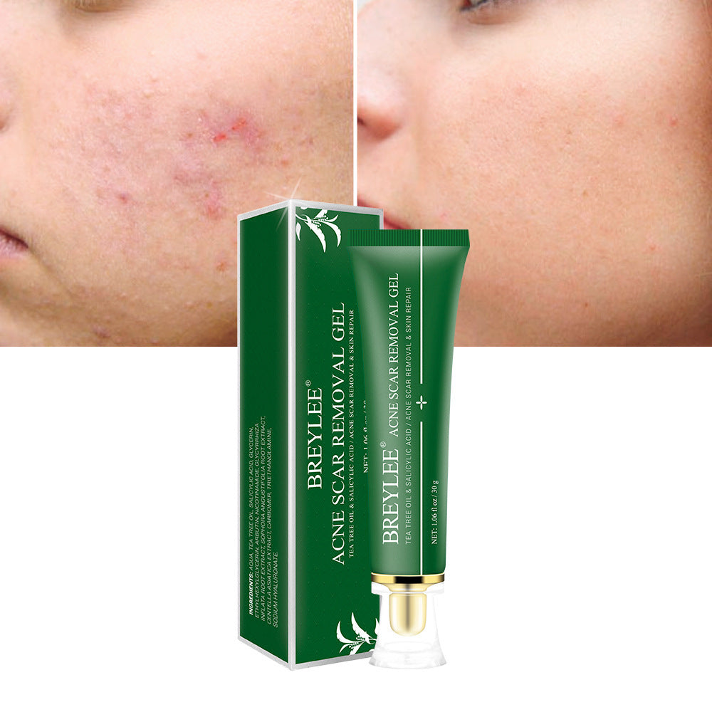 Breylee Acne Scar Removal Gel Comparison