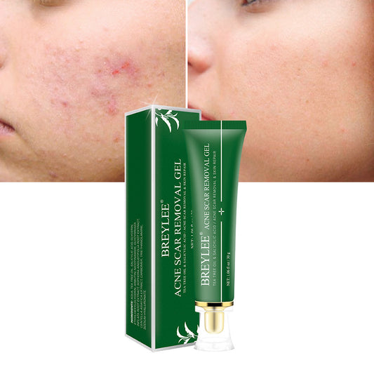 Breylee Acne Scar Removal Gel Comparison