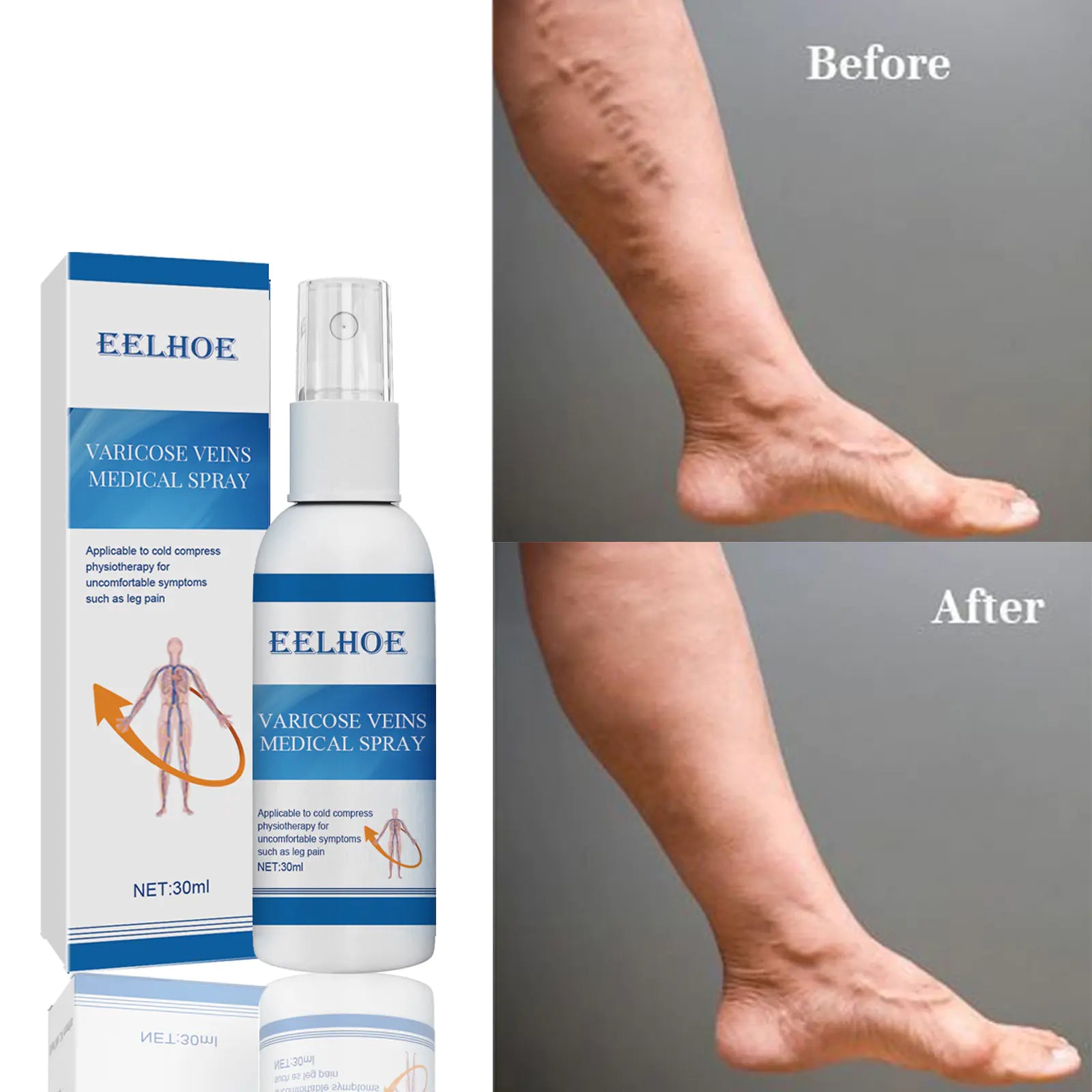 EELHOE Varicose Vein Massage Spray for Leg Pain Relief