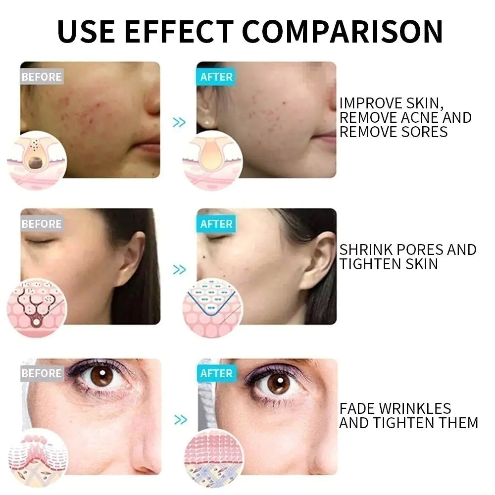 Facial Mask Machine with Massage and Skincare Effects Comparison