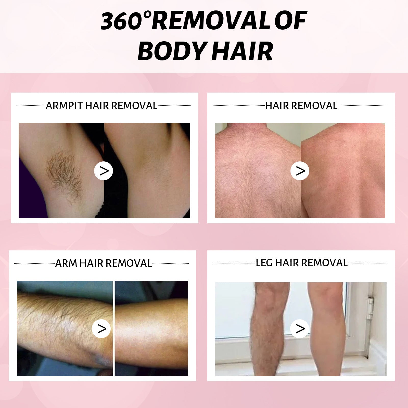 Non-irritating Gentle Foam Mousse Hair Removal Spray Comparisons